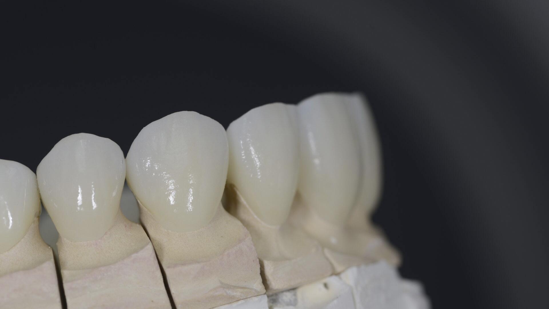 Zirconio para todas las piezas